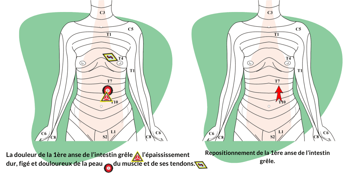 candidose digestive massages specifiques